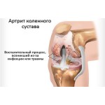 Глюкозамин Экстракт 3200 мг для лечения суставов (100 капсул) Глюкозамин Экстракт 3200 мг для лечения суставов (100 капсул)