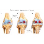 Глюкозамин-хондроитиновый комплекс Glucosamin для лечения суставов (60 капсул)
