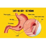 Драже Huynh Long от язвы венадцатиперстной кишки и желудка Драже Huynh Long от язвы венадцатиперстной кишки и желудка