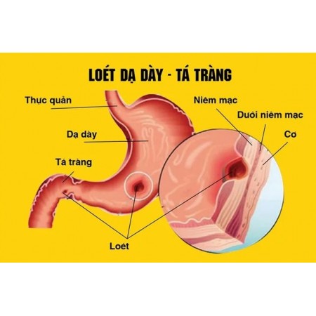 Huynh Long от язвы