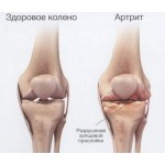 Глюкозамин-хондроитиновый комплекс Glucosamin для лечения суставов (60 капсул)