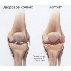 Комплекс глюкозамин