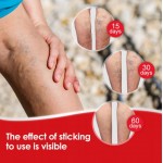 Китайский пластырь от варикоза Varicose Veins Plaster (6 шт)